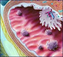 Название: bladder_cancer.jpg
Просмотров: 1201

Размер: 13.8 Кб