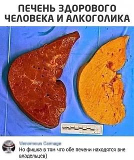 Черный юмор. Или не юмор.-pechen-alko.jpg